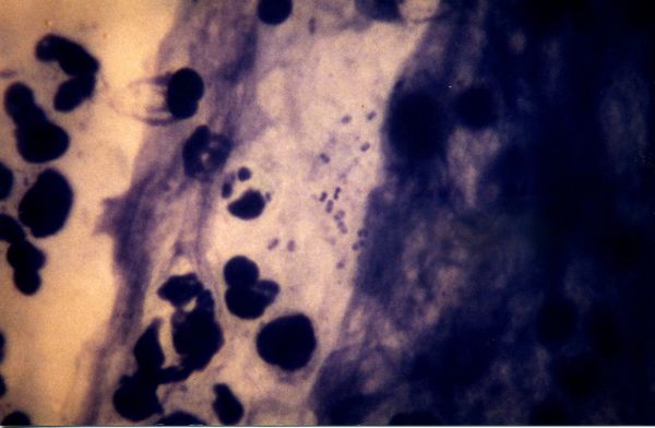 H.ducreyi 2