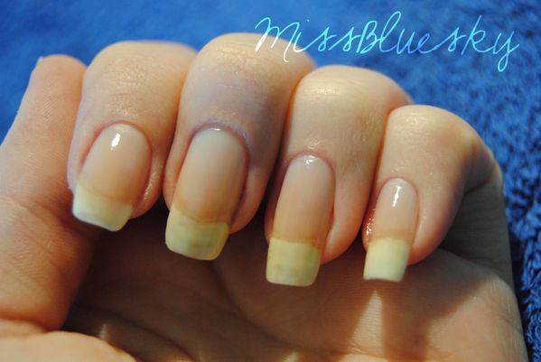 BLOG82