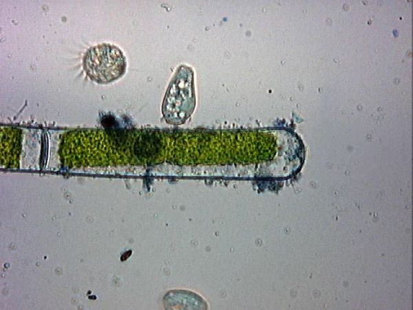 ciliés pressés actinophrys 20000