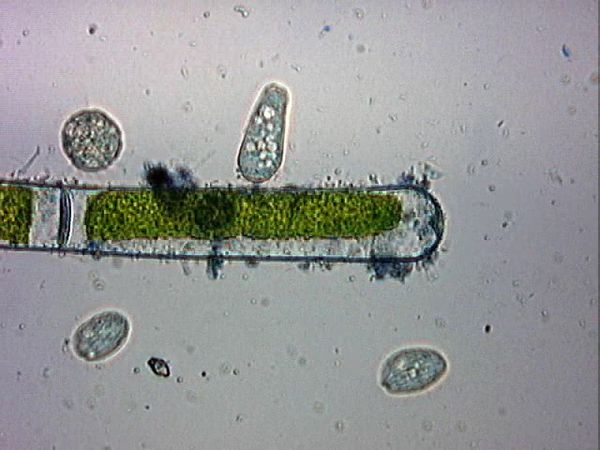 ciliés pressés actinophrys0000