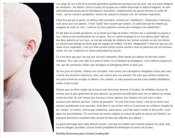 article-albinos.jpg