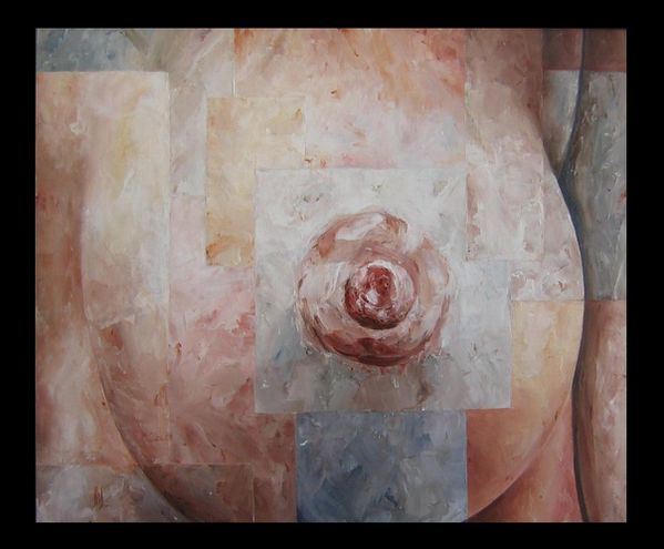 breast augmentation - after