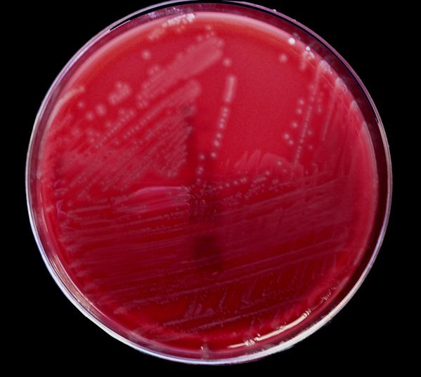 listeria culture