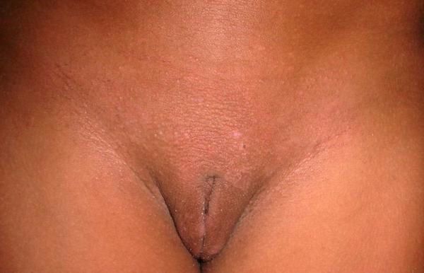 Shaved Pubic Area Pics Porn Pic