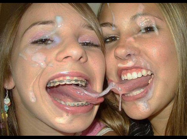 Braces Porn Galleries 47