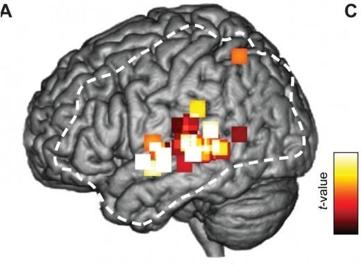 brain1_530x388.jpg