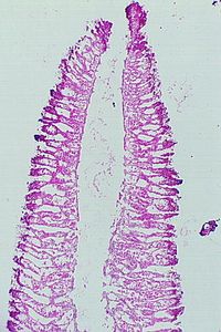 éponges sponges00004224