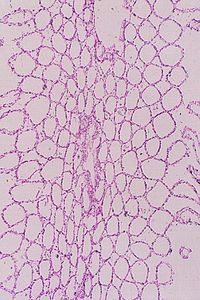 éponges sponges00004228