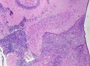 protozoa 00004195