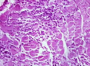 protozoa 00004219
