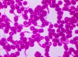protozoa 00004221