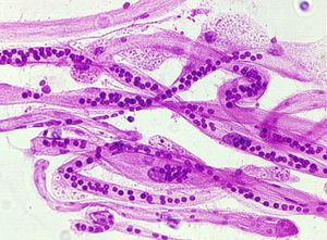 protozoa 00004193