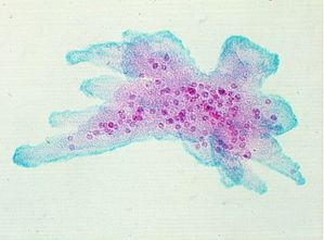 protozoa 00004204