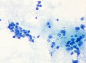 protozoa 00004216