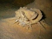 Un Lithopedion Ou Un Foetus Calcifie Intra Abdominal Doc De Haguenau