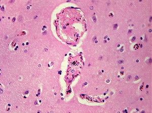 protozoa 00004207