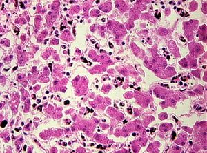 protozoa 00004208