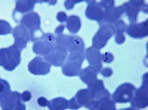 protozoa 00004209