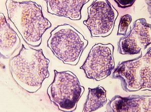 protozoa 00004210