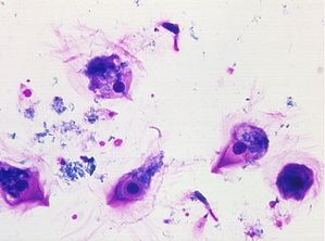 protozoa 00004218
