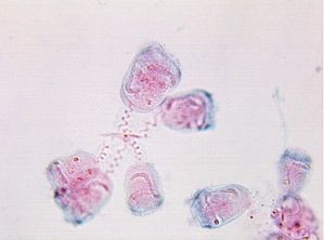 protozoa 00004222