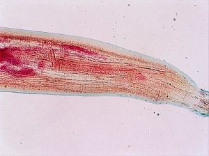 acanthocéphale 00004335