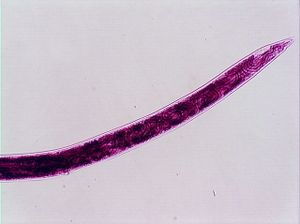 nématode 00004311