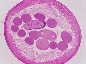 nématode 00004314