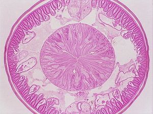 nématode 00004316