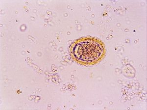 nématode 00004319