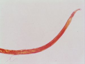 nématode 00004323