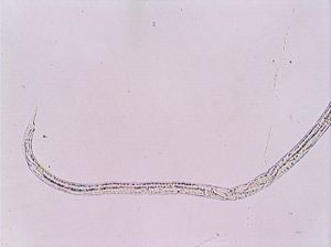 nématode 00004324