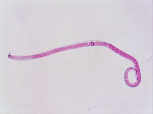 nématode 00004326