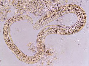 nématode 00004327