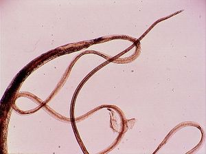 nématode 00004332