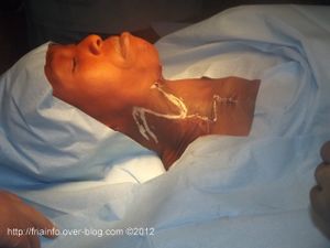 CHIRURGIE-REPARATRICE--1--1.JPG