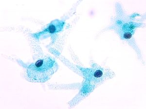 protozoa 00004176