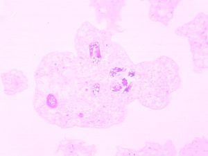 protozoa 00004177