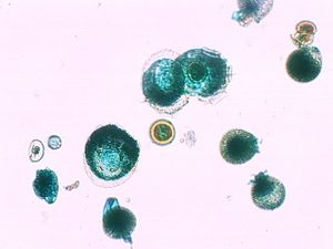 protozoa 00004178