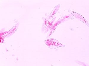 protozoa 00004180