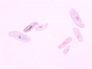 protozoa 00004181