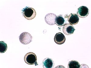 protozoa 00004183