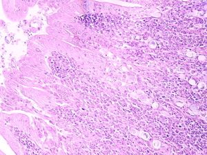 protozoa 00004184