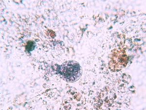 protozoa 00004185