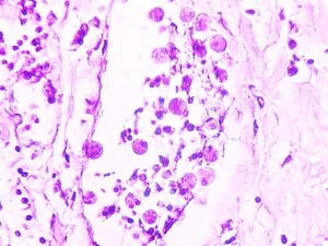 protozoa 00004187