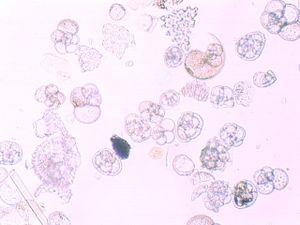 protozoa 00004188