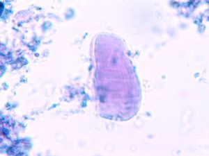 protozoa 00004189