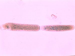 protozoa 00004190
