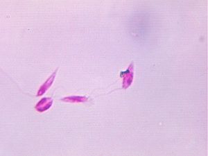 protozoa 00004192