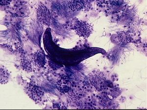 protozoa 00004194